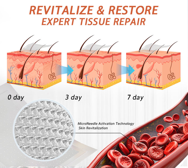 🧑⚕️🔥Celsiora® Vein Ease Microneedle Care Patch(For Spider Veins, Varicose Veins, Swelling & Leg Fatigue)