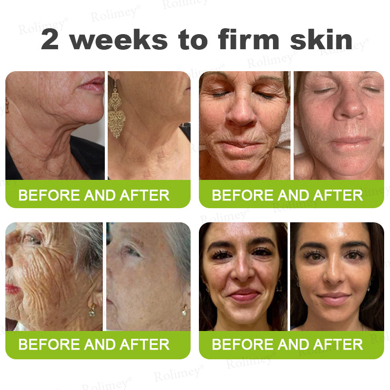 🌹Made and shipped from the CA 💫Rolimey® Botox & Vita-A Retinol Shot Wrinkle-Lift Tightening cream - Last Day Promotion 70% OFF