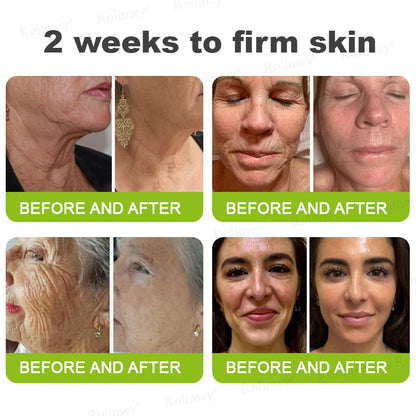 🌹Made and shipped from the CA 💫Rolimey® Botox & Vita-A Retinol Shot Wrinkle-Lift Tightening cream - Last Day Promotion 70% OFF