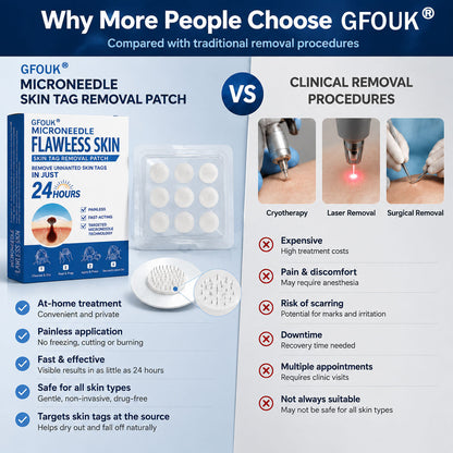 💯𝐎𝐟𝐟𝐢𝐜𝐢𝐚𝐥 𝐒𝐭𝐨𝐫𝐞 | GFOUK® 🌿 𝐁𝐨𝐭𝐚𝐧𝐢𝐜𝐚𝐥 𝐌𝐢𝐜𝐫𝐨𝐧𝐞𝐞𝐝𝐥𝐞 𝐇𝐲𝐝𝐫𝐨𝐜𝐨𝐥𝐥𝐨𝐢𝐝 𝐏𝐚𝐭𝐜𝐡 (𝐅𝐨𝐫 𝐒𝐤𝐢𝐧 𝐓𝐚𝐠𝐬, 𝐒𝐦𝐚𝐥𝐥 𝐒𝐤𝐢𝐧 𝐆𝐫𝐨𝐰𝐭𝐡𝐬, 𝐖𝐚𝐫𝐭𝐬, 𝐌𝐨𝐥𝐞𝐬, 𝐀𝐠𝐞 𝐒𝐩𝐨𝐭𝐬 & 𝐏𝐢𝐠𝐦𝐞𝐧𝐭𝐚𝐭𝐢𝐨𝐧 𝐂𝐨𝐧𝐜𝐞𝐫𝐧𝐬)