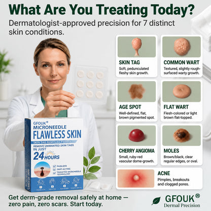 🎯🏆 𝐎𝐟𝐟𝐢𝐜𝐢𝐚𝐥 𝐒𝐭𝐨𝐫𝐞 | GFOUK® 🌿 𝐁𝐨𝐭𝐚𝐧𝐢𝐜𝐚𝐥 𝐌𝐢𝐜𝐫𝐨𝐧𝐞𝐞𝐝𝐥𝐞 𝐇𝐲𝐝𝐫𝐨𝐜𝐨𝐥𝐥𝐨𝐢𝐝 𝐏𝐚𝐭𝐜𝐡 (𝐅𝐨𝐫 𝐒𝐤𝐢𝐧 𝐓𝐚𝐠𝐬, 𝐒𝐦𝐚𝐥𝐥 𝐒𝐤𝐢𝐧 𝐆𝐫𝐨𝐰𝐭𝐡𝐬, 𝐖𝐚𝐫𝐭𝐬, 𝐌𝐨𝐥𝐞𝐬, 𝐀𝐠𝐞 𝐒𝐩𝐨𝐭𝐬 & 𝐏𝐢𝐠𝐦𝐞𝐧𝐭𝐚𝐭𝐢𝐨𝐧 𝐂𝐨𝐧𝐜𝐞𝐫𝐧𝐬)