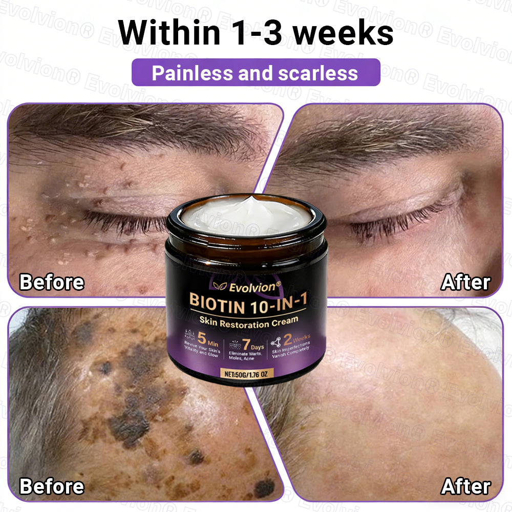 👨‍⚕️Over 100,000 units sold💕-🍁Evolvion® Biotin 10-in-1 Skin Restoration Cream