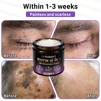 👨‍⚕️Over 100,000 units sold💕-🍁Evolvion® Biotin 10-in-1 Skin Restoration Cream