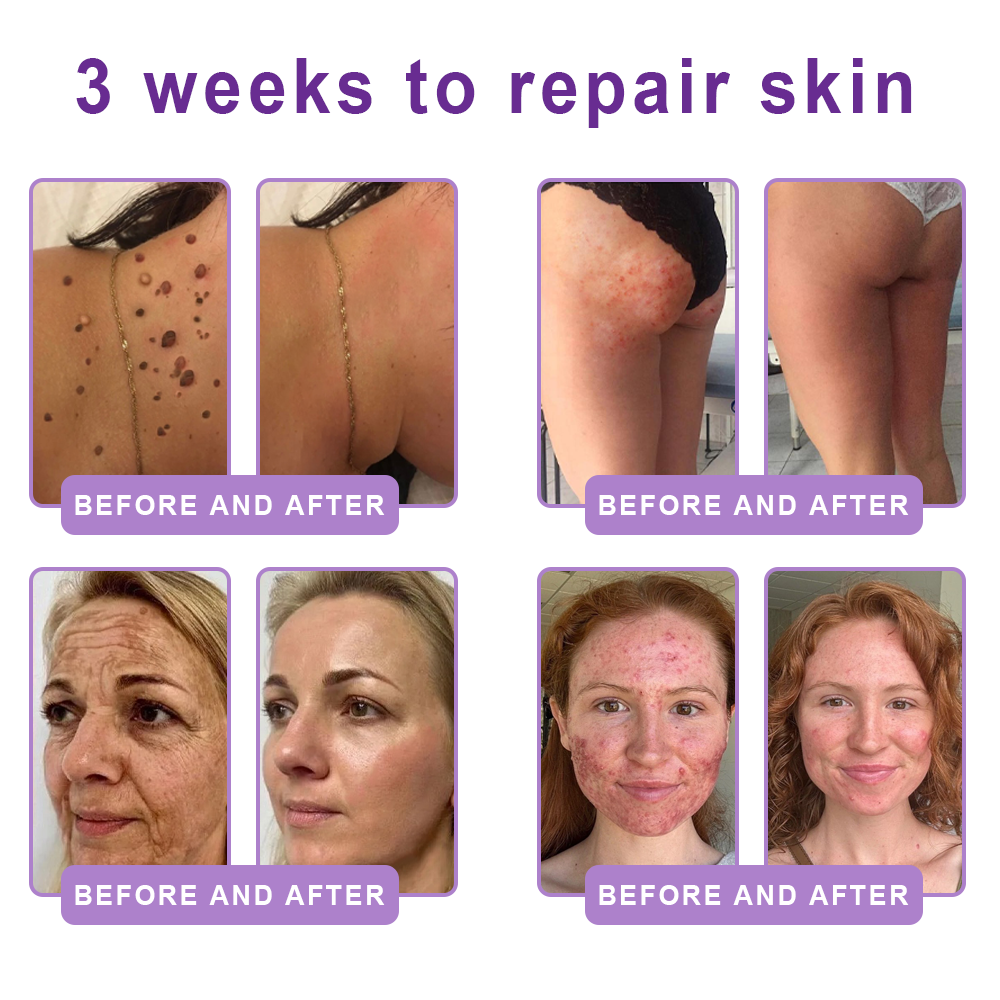 Trilumia®PDRN Multi-Peptide Firming Body Roller Cream™