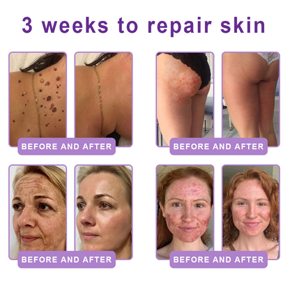 Trilumia®PDRN Multi-Peptide Firming Body Roller Cream™