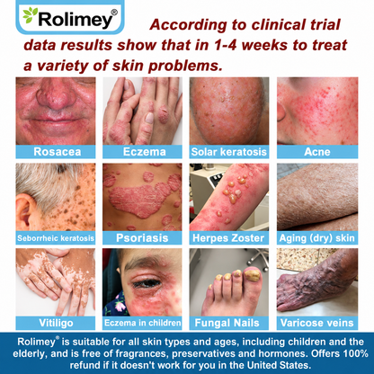 ✅Official Store: Rolimey® Magnesium skin repair cream