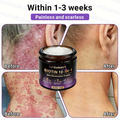 👨‍⚕️Over 100,000 units sold💕-🍁Evolvion® Biotin 10-in-1 Skin Restoration Cream