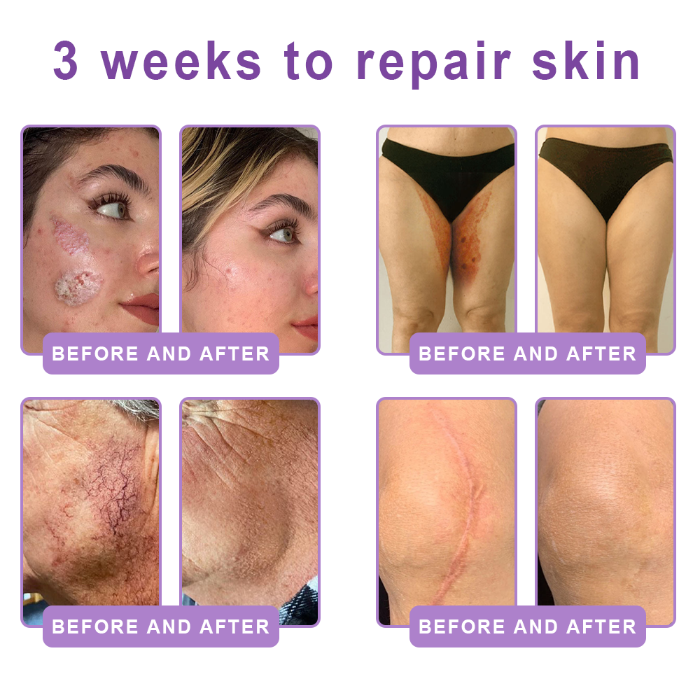 Trilumia®PDRN Multi-Peptide Firming Body Roller Cream™