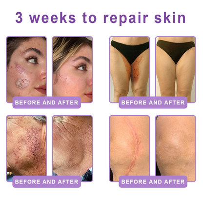Trilumia®PDRN Multi-Peptide Firming Body Roller Cream™