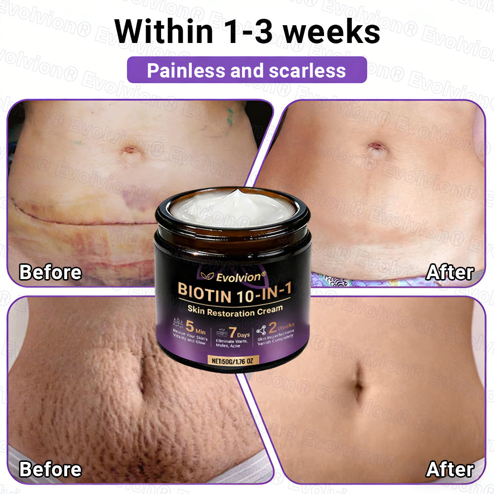 👨‍⚕️Over 100,000 units sold💕-🍁Evolvion® Biotin 10-in-1 Skin Restoration Cream