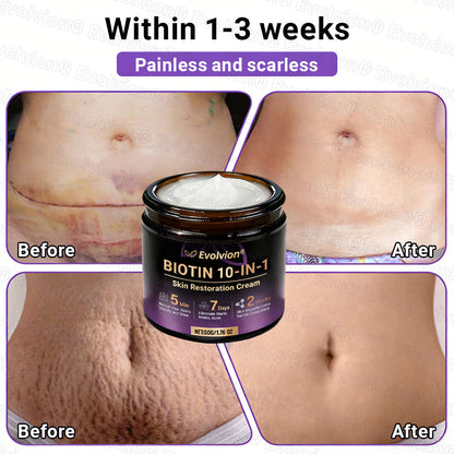 👨‍⚕️Over 100,000 units sold💕-🍁Evolvion® Biotin 10-in-1 Skin Restoration Cream