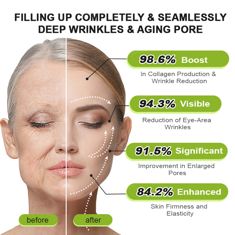 🌹Made and shipped from the CA 💫Rolimey® Botox & Vita-A Retinol Shot Wrinkle-Lift Tightening cream - Last Day Promotion 70% OFF