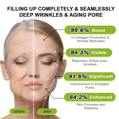 🌹Made and shipped from the CA 💫Rolimey® Botox & Vita-A Retinol Shot Wrinkle-Lift Tightening cream - Last Day Promotion 70% OFF