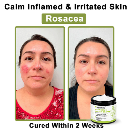 ✅Made in the USA: Rolimey® Magnesium herbal skin repair cream
