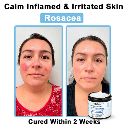 ✅Official Store: Rolimey® Magnesium skin repair cream