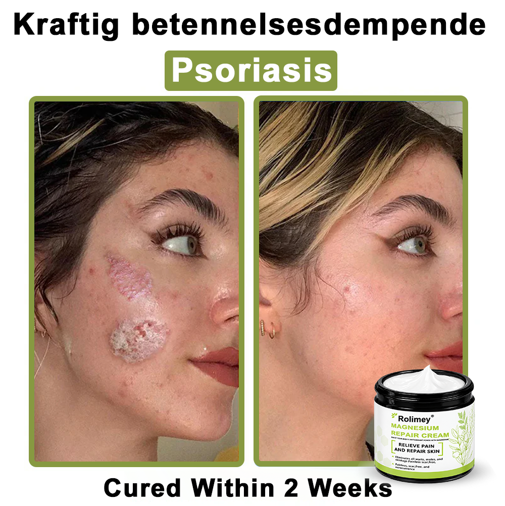 ✅Made in the USA: Rolimey® Magnesium herbal skin repair cream