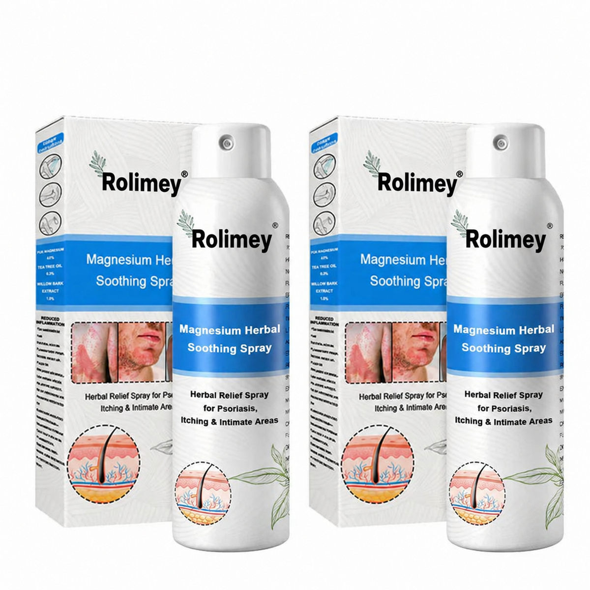 ✅Official Store: Rolimey®Magnesium Herbal Psoriasis Spray⚕️Health Canada Certified (Relief for Psoriasis and Eczema, Improvement of Bacterial Infections in the Genital Area, Elieves joint pain and neuropathic pain)