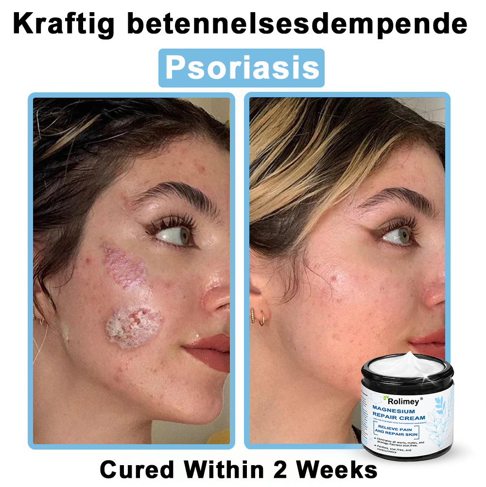✅Official Store: Rolimey® Magnesium skin repair cream