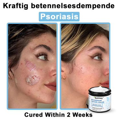 ✅Official Store: Rolimey® Magnesium skin repair cream