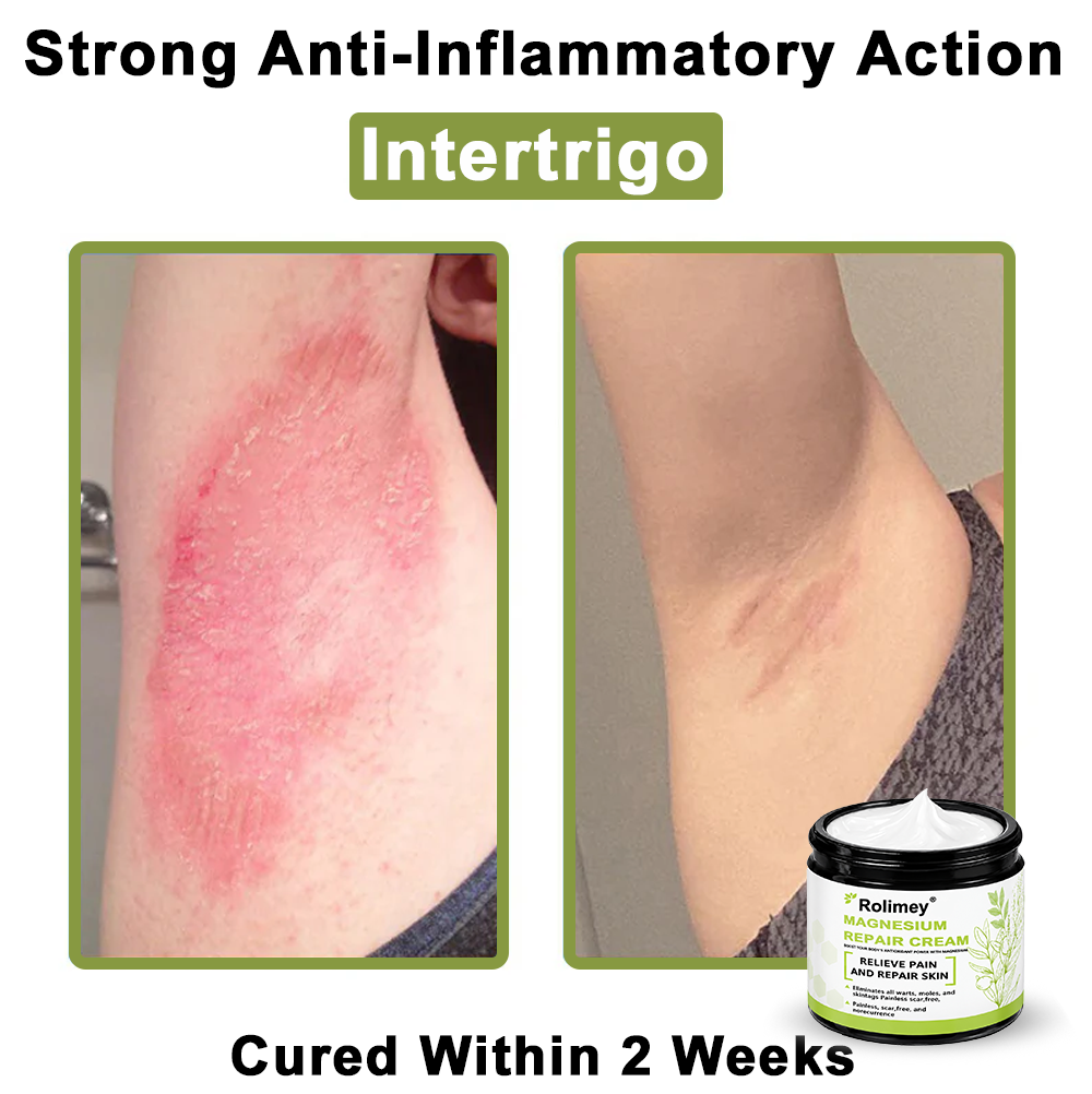 ✅Made in the USA: Rolimey® Magnesium herbal skin repair cream