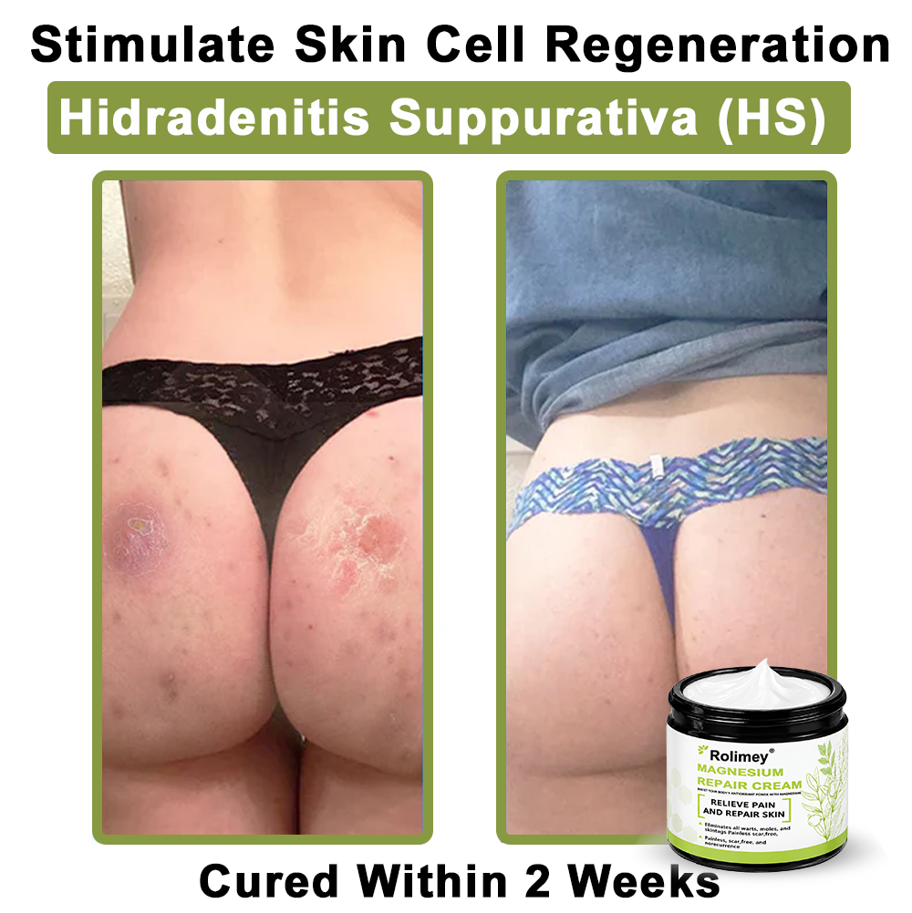 ✅Made in the USA: Rolimey® Magnesium herbal skin repair cream