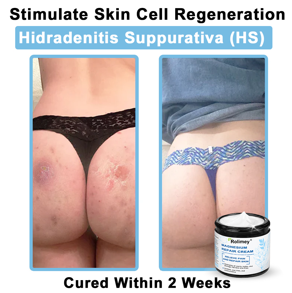 ✅Official Store: Rolimey® Magnesium skin repair cream