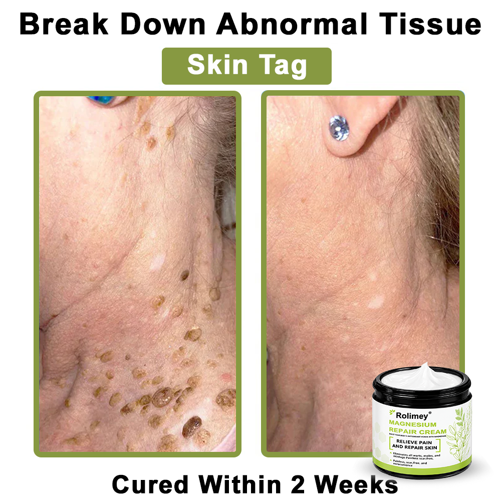 ✅Made in the USA: Rolimey® Magnesium herbal skin repair cream