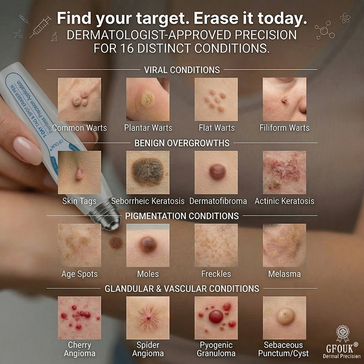 👨‍⚕️𝐎𝐟𝐟𝐢𝐜𝐢𝐚𝐥 𝐁𝐫𝐚𝐧𝐝 𝐒𝐭𝐨𝐫𝐞 |🔥GFOUK® 7-𝐷𝑎𝑦 𝗧𝐚𝐠 & 𝗦𝗽𝐨𝐭 𝐄𝐫𝒂𝒔𝒆𝒓(Zero Pain, Zero 𝐒𝐜𝐚𝒓𝒔 Rollerball)