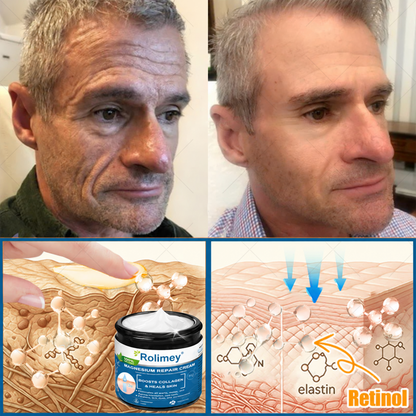 ✅Official Store: Rolimey® Magnesium Skin Repair Cream (Smooths Wrinkles, Improves Skin Firmness, Tightens Skin)