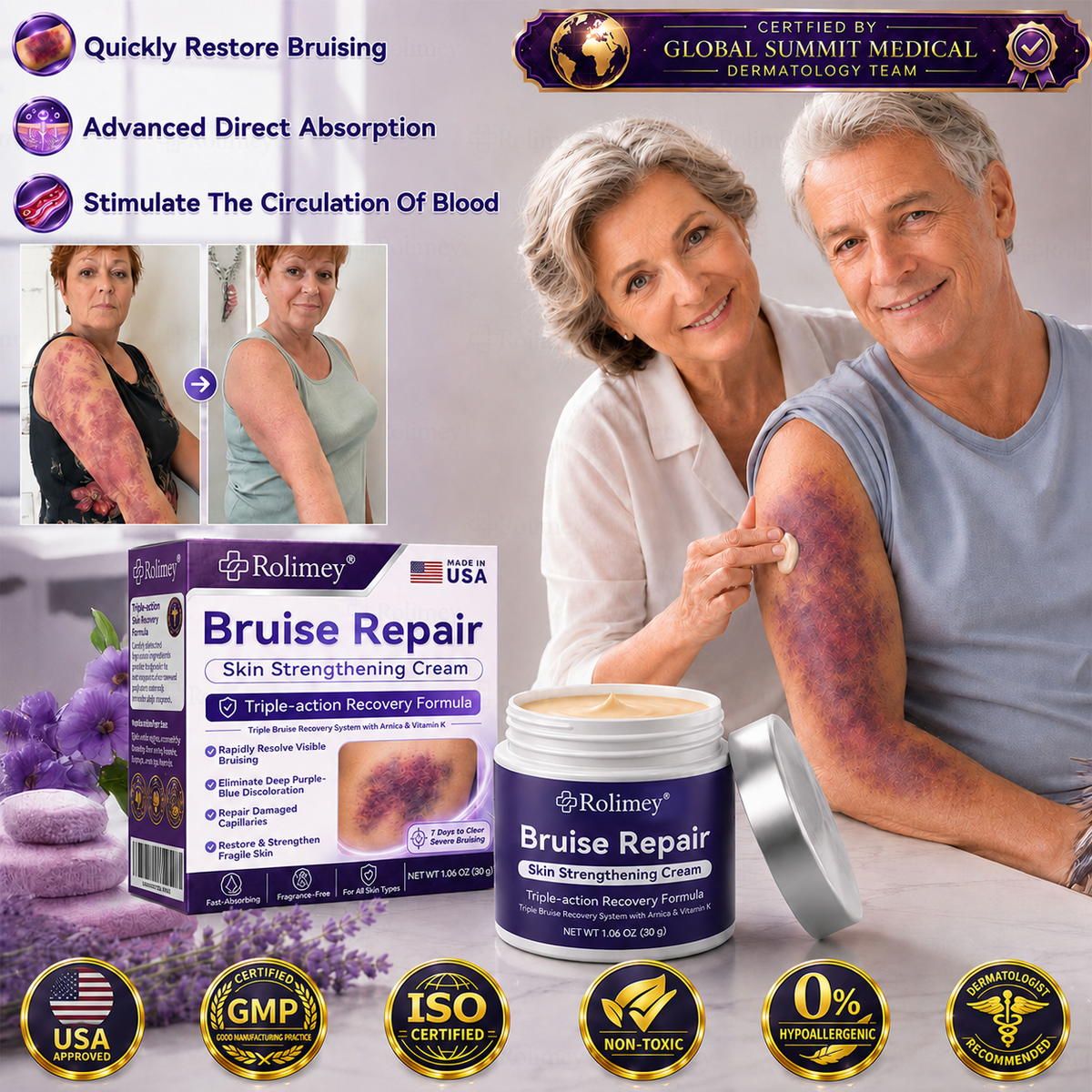 👩‍⚕️🏆Over 100,000 units sold🔥 - Rolimey® cream to repair bruises and strengthen the skin