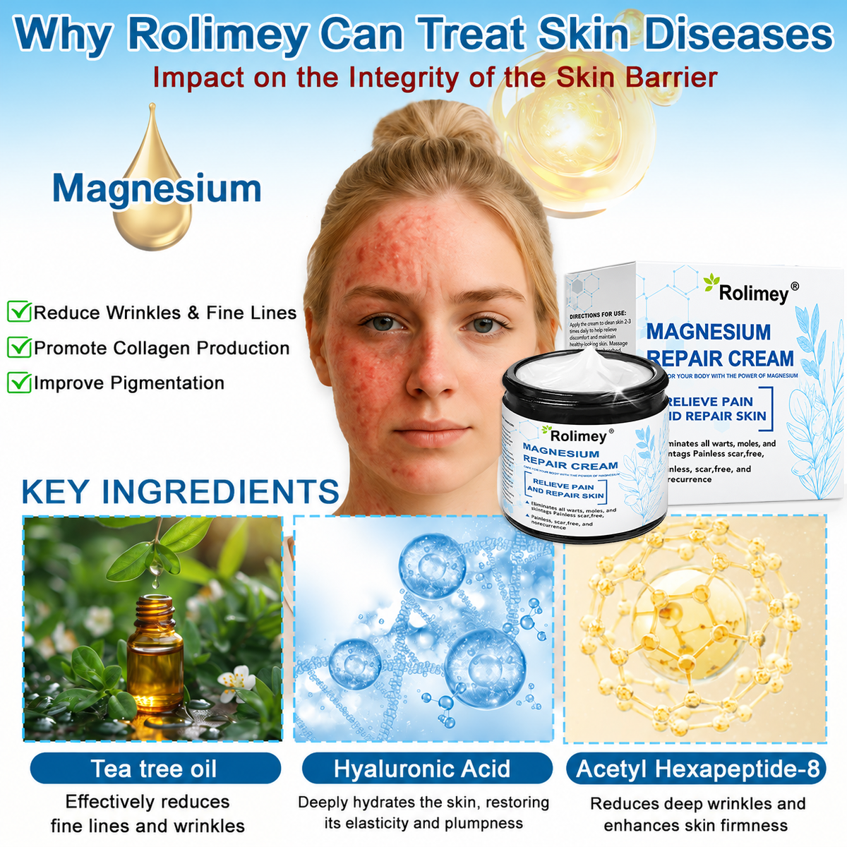 ✅Official Store: Rolimey® Magnesium skin repair cream