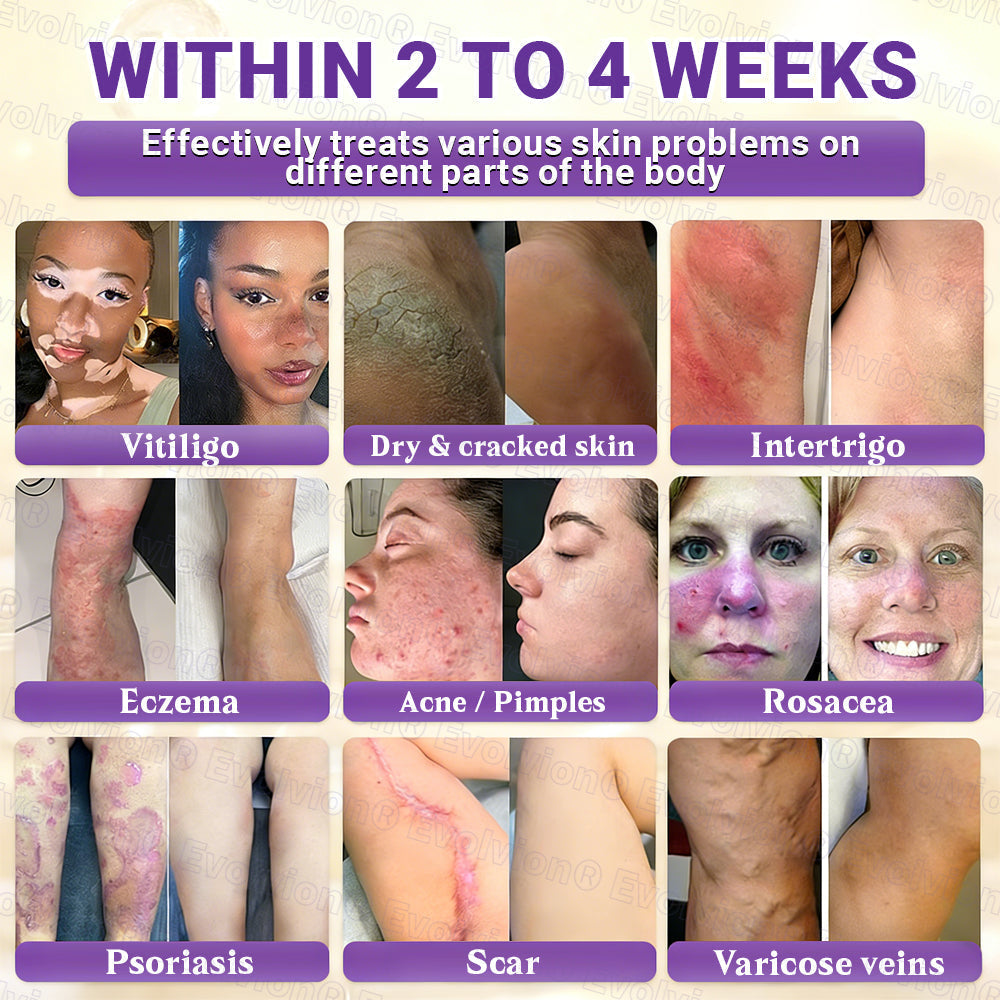👨‍⚕️Over 100,000 units sold💕-🍁Evolvion® Biotin 10-in-1 Skin Restoration Cream