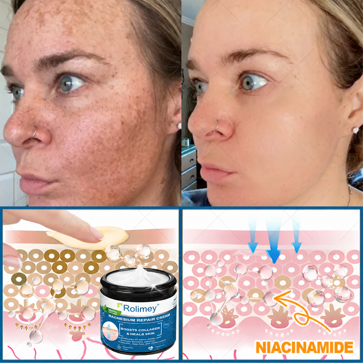 ✅Official Store: Rolimey® Magnesium Skin Repair Cream (Smooths Wrinkles, Improves Skin Firmness, Tightens Skin)