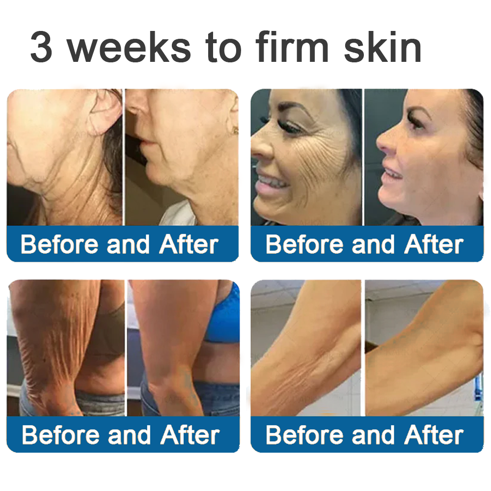 ✅Official Store: Rolimey® Magnesium Skin Repair Cream (Smooths Wrinkles, Improves Skin Firmness, Tightens Skin)