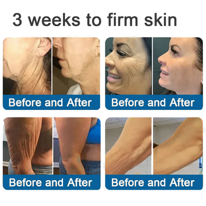 ✅Official Store: Rolimey® Magnesium Skin Repair Cream (Smooths Wrinkles, Improves Skin Firmness, Tightens Skin)
