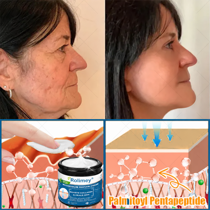 ✅Official Store: Rolimey® Magnesium Skin Repair Cream (Smooths Wrinkles, Improves Skin Firmness, Tightens Skin)