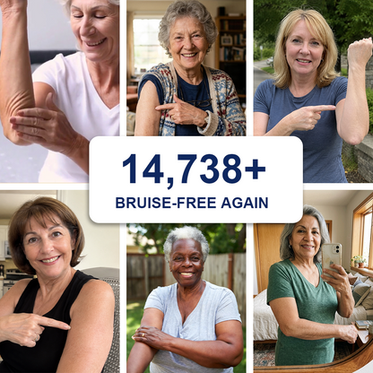 👨‍⚕️Over 100,000 units sold💕-🗽Evolvion® Bruise Repair & Skin-Strengthening Cream