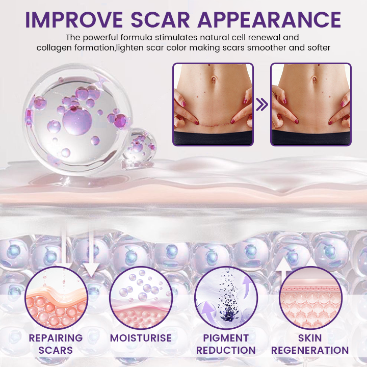 Timilk® ReGenScar Stem Cell Scar Gel