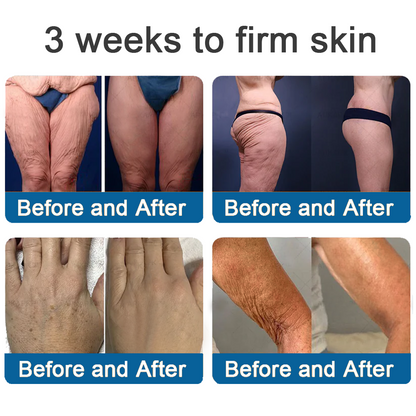 ✅Official Store: Rolimey® Magnesium Skin Repair Cream (Smooths Wrinkles, Improves Skin Firmness, Tightens Skin)