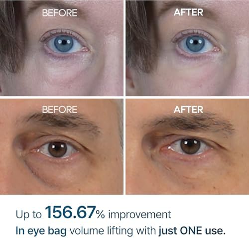 Dr.Melaxin Eyephalt Eyebag Cream for Puffiness, Dark Circles & Fine Lines, Wrinkle, EGF Anti-Aging Under Eye Moisturizer with Niacinamide&Ceramide 0.33 fl.oz.