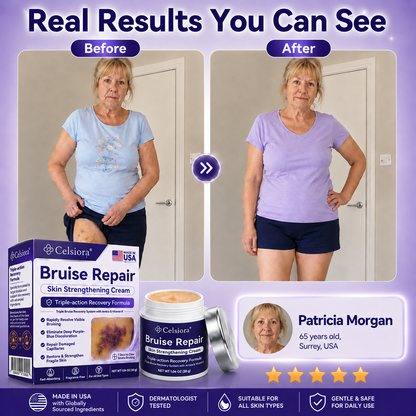 👩‍⚕️🏆Over 100,000 units sold🔥 - Rolimey® cream to repair bruises and strengthen the skin