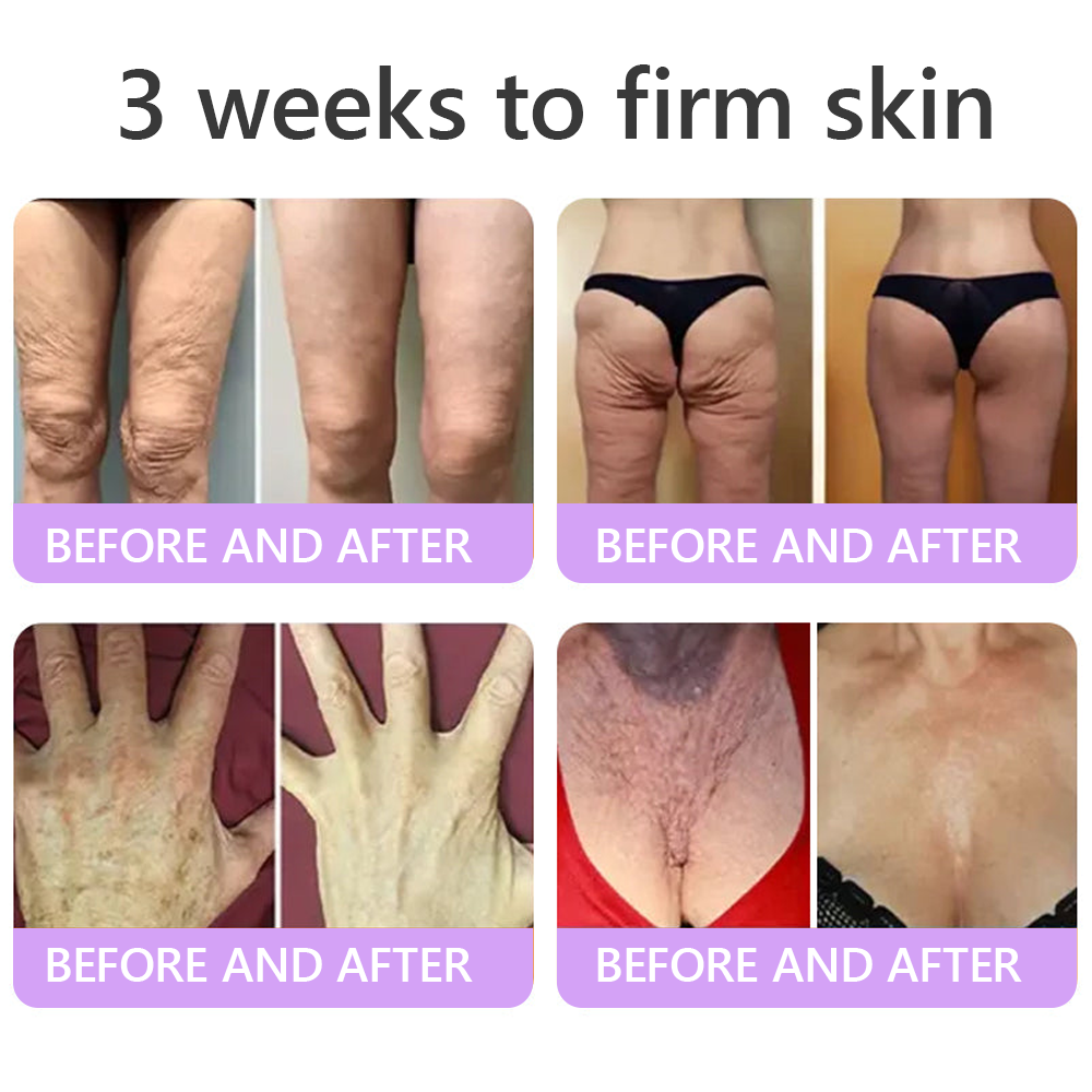 Trilumia®PDRN Multi-Peptide Firming Body Roller Cream™