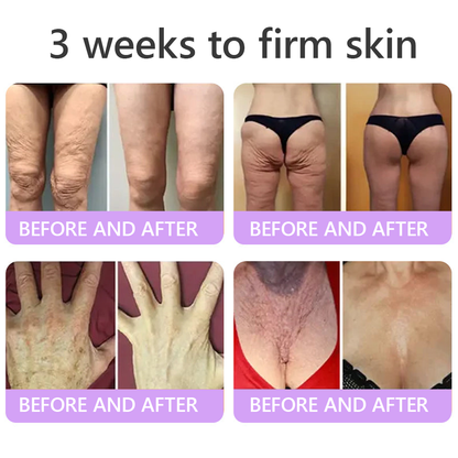 Trilumia®PDRN Multi-Peptide Firming Body Roller Cream™