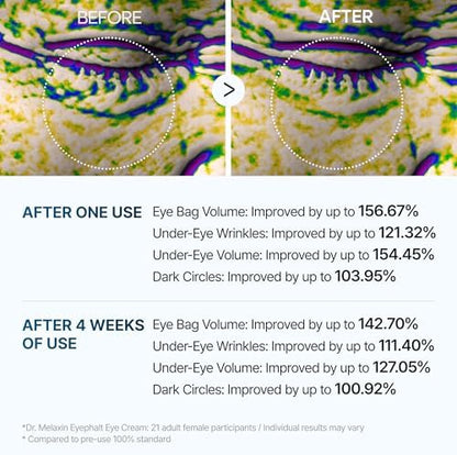 Dr.Melaxin Eyephalt Eyebag Cream for Puffiness, Dark Circles & Fine Lines, Wrinkle, EGF Anti-Aging Under Eye Moisturizer with Niacinamide&Ceramide 0.33 fl.oz.