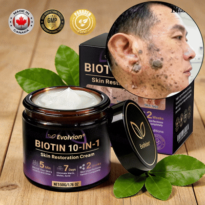 👨‍⚕️Over 100,000 units sold💕-🍁Evolvion® Biotin 10-in-1 Skin Restoration Cream