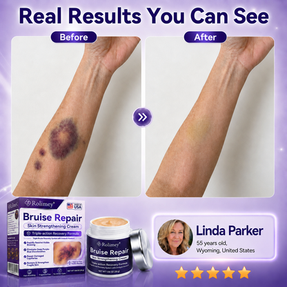👩‍⚕️🏆Over 100,000 units sold🔥 - Rolimey® cream to repair bruises and strengthen the skin