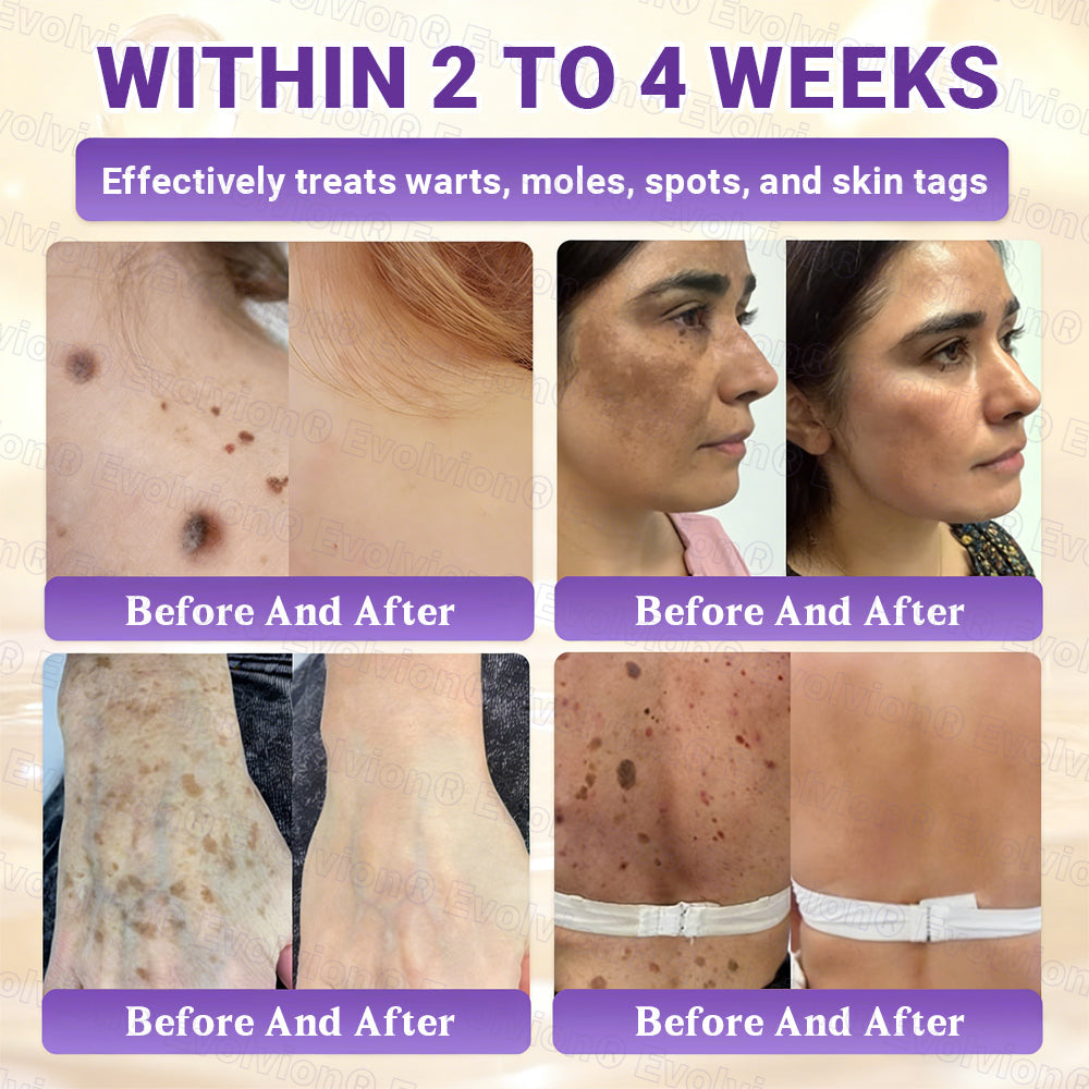 👨‍⚕️Over 100,000 units sold💕-🍁Evolvion® Biotin 10-in-1 Skin Restoration Cream