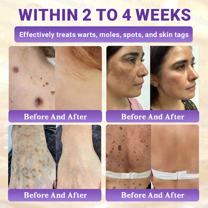 👨‍⚕️Over 100,000 units sold💕-🍁Evolvion® Biotin 10-in-1 Skin Restoration Cream