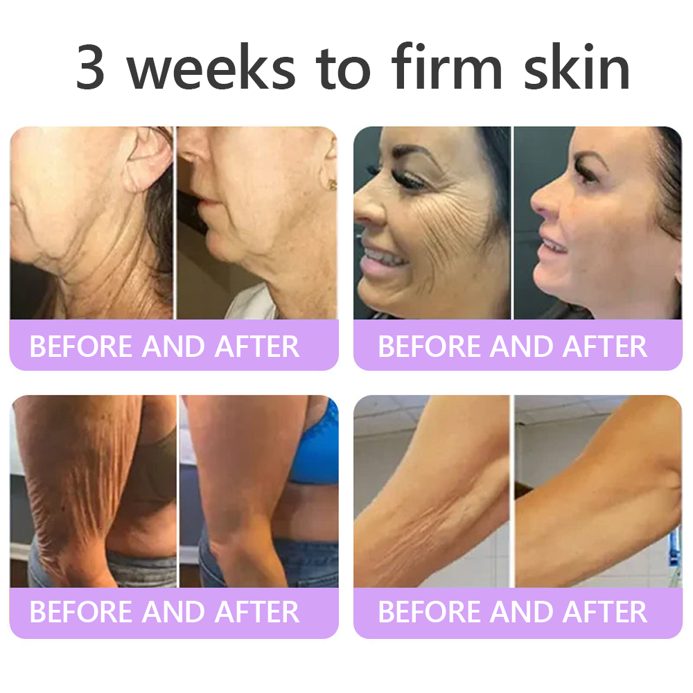 Trilumia®PDRN Multi-Peptide Firming Body Roller Cream™