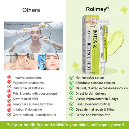 🌹Made and shipped from the CA 💫Rolimey® Botox & Vita-A Retinol Shot Wrinkle-Lift Tightening cream - Last Day Promotion 70% OFF